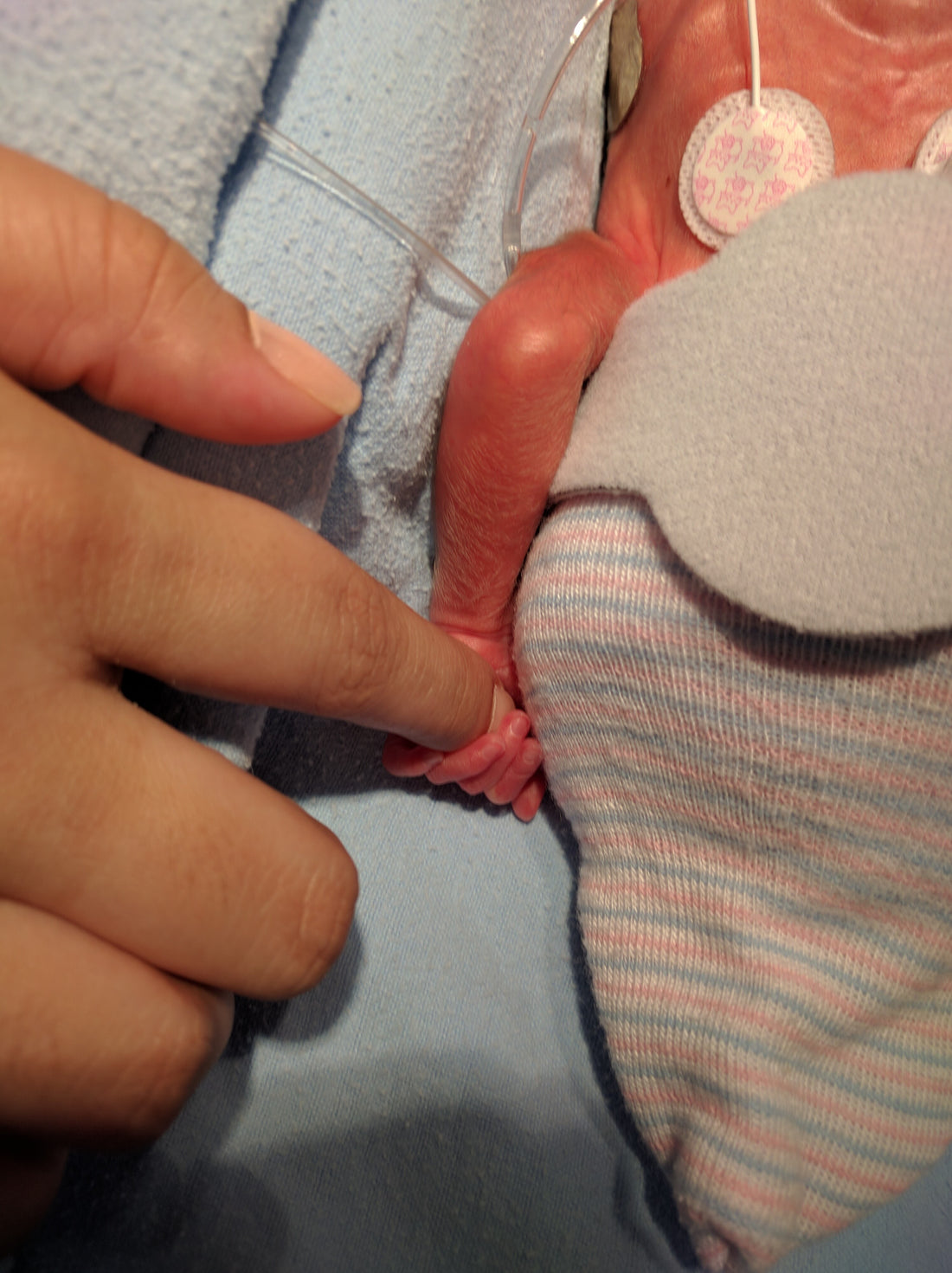 26 semanas: Llegó la hora de nacer prematuros. PARTE 1.
