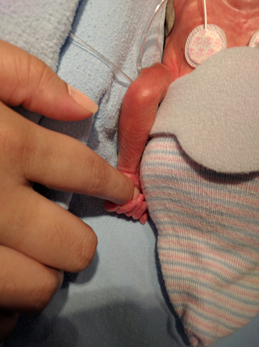 26 semanas: Llegó la hora de nacer prematuros. PARTE 1.